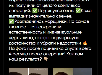 44labs: Посты из ВК (s44labs.vkposts) - решение для Битрикс